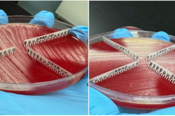 罕见菌：冢村菌（腹膜透析相关性感染）