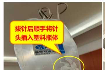 护士区病房拔针时，要不要带个处理针头的？