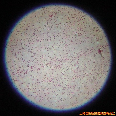 布鲁菌镜下形态.jpg