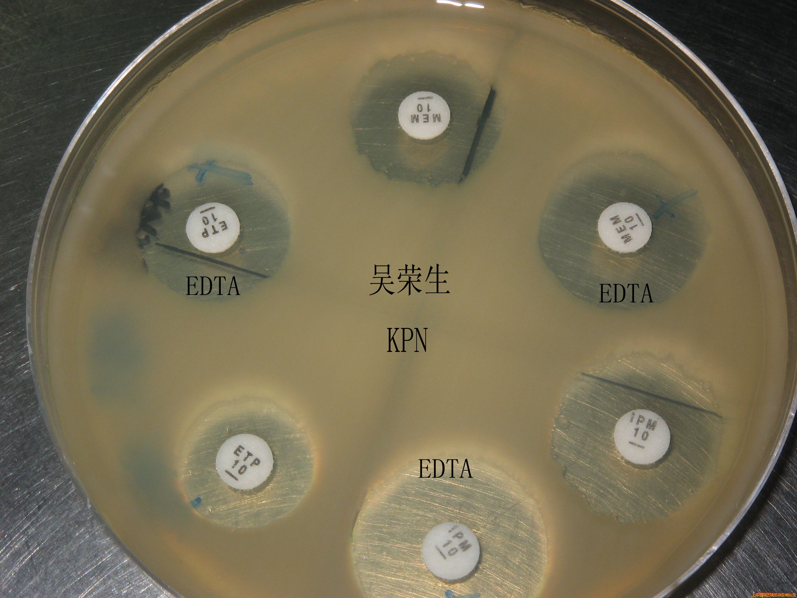 NDM-1图片07.jpg