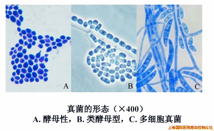 真菌的镜下形态.jpg