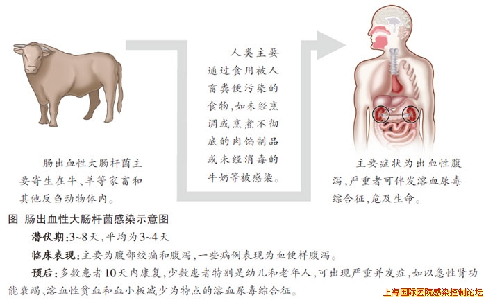 肠出血性大肠杆菌感染示意图