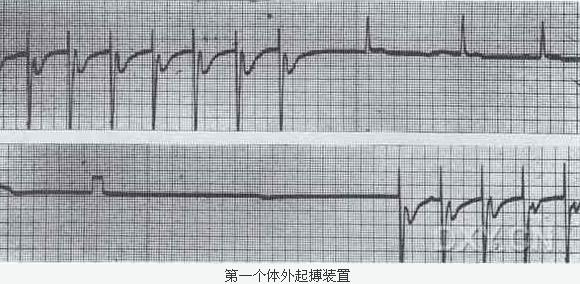 体外起搏.jpg