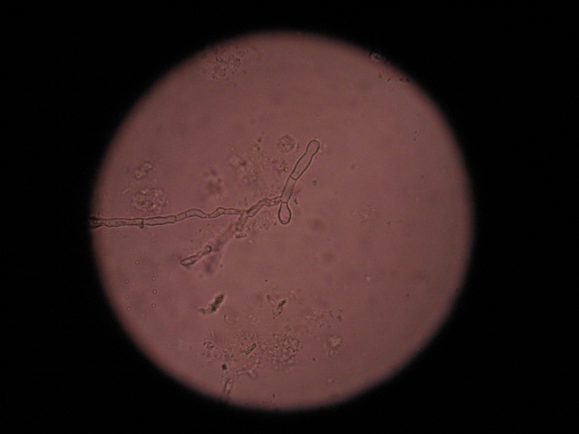 细菌图片（相机） 067.jpg