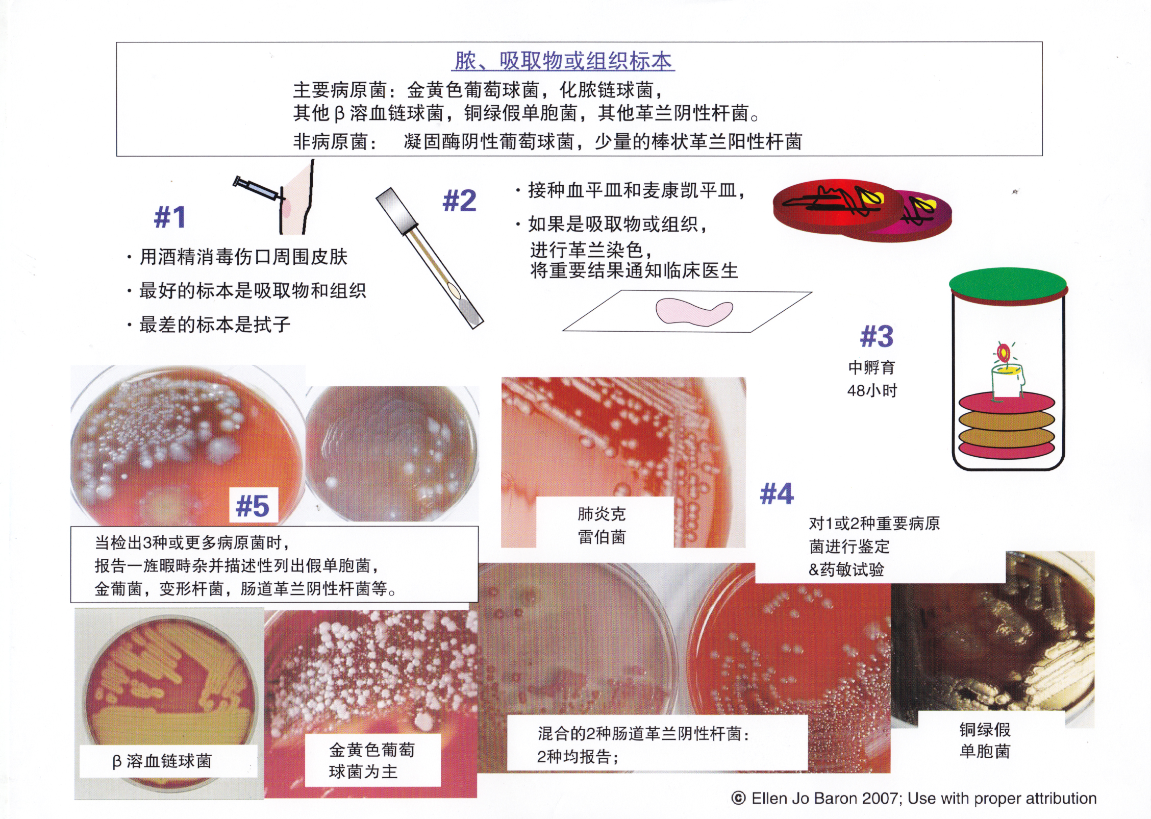 6脓 吸取物或组织.jpg