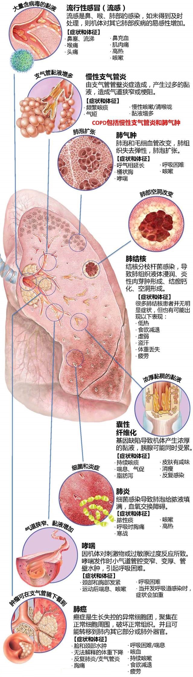 各种肺部疾病.jpg