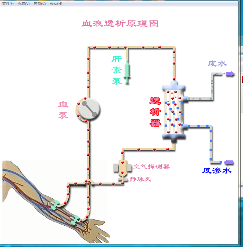 透析原理图.png