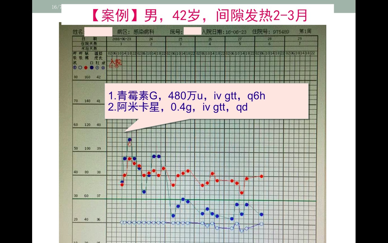 心内膜炎4.jpg