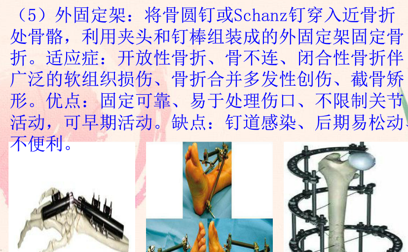 20160808111113.png