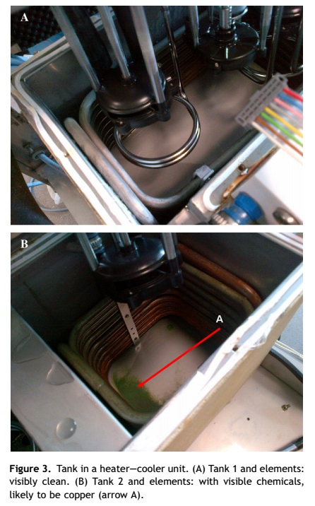 heater cooler unit tank contamination.jpg