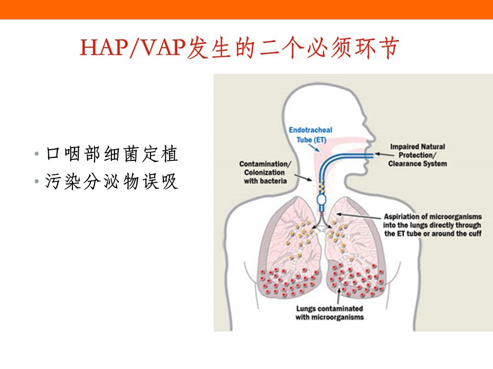 老年患者人工气道护理与肺部感染预防3.28.jpg
