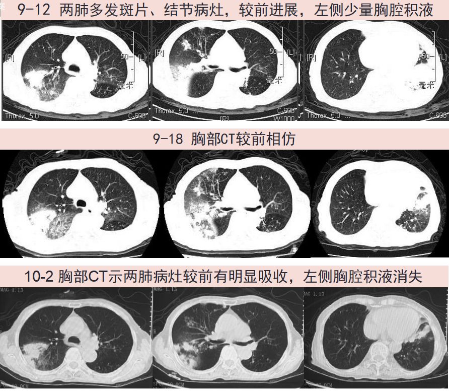 kyNxZ7LXX1530A1l.jpg