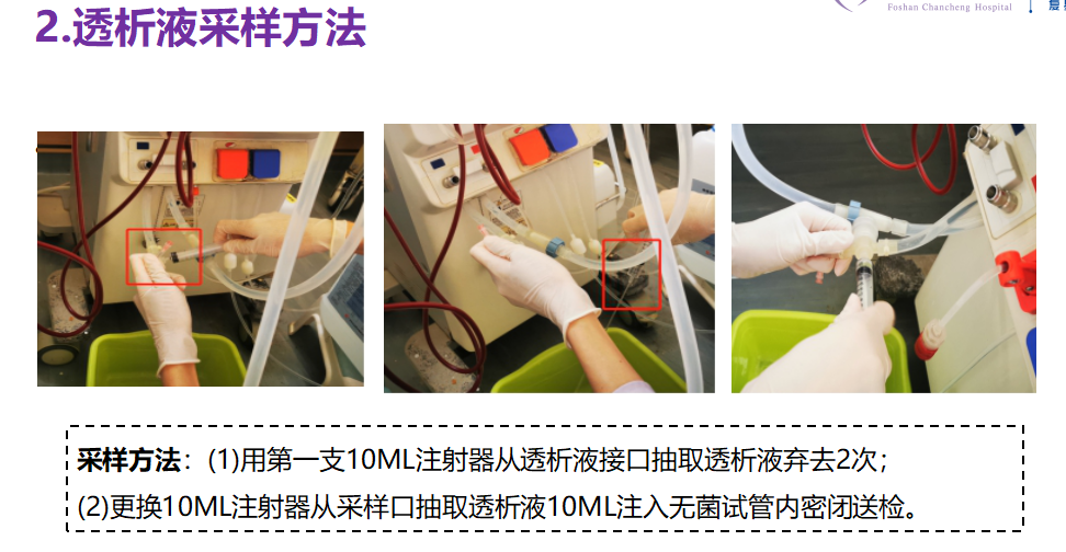 血透.png