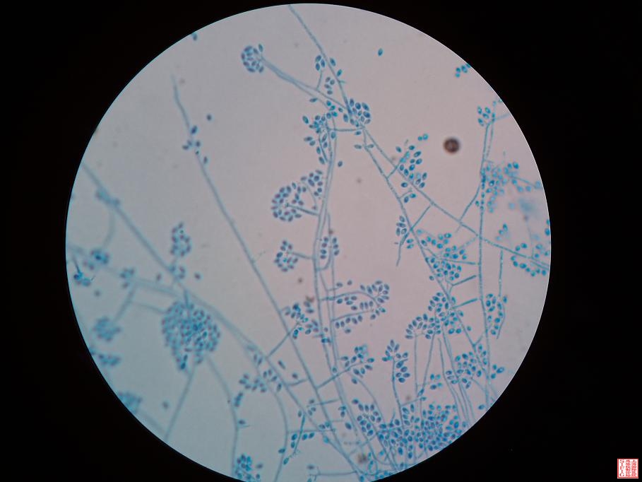 镜下菌丝相０３