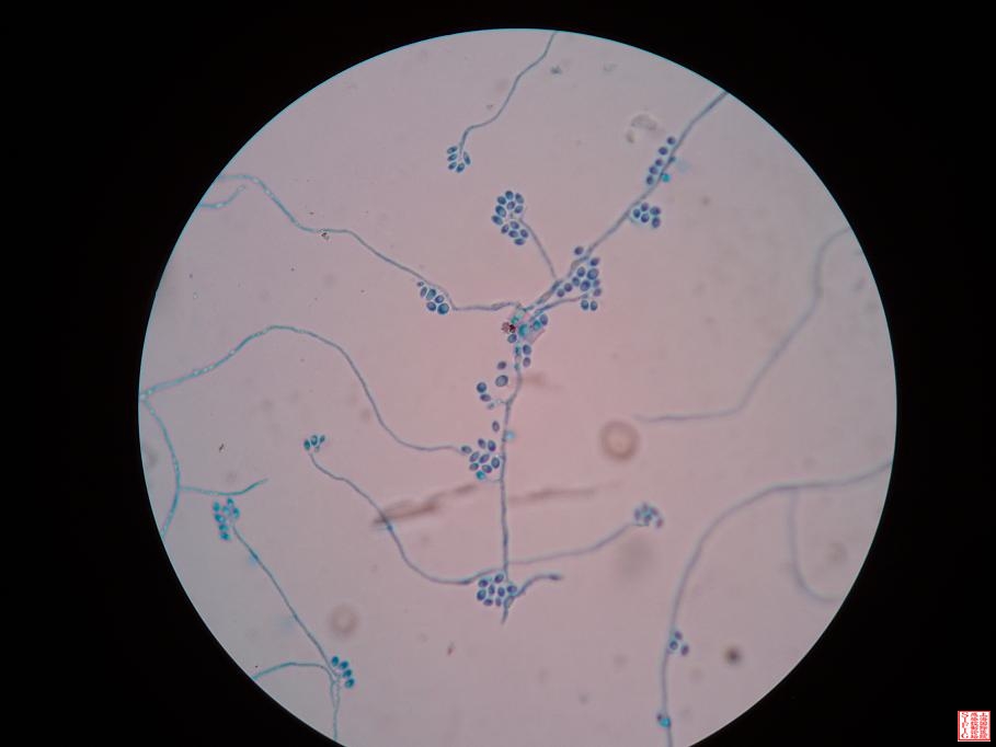 镜下菌丝相０２