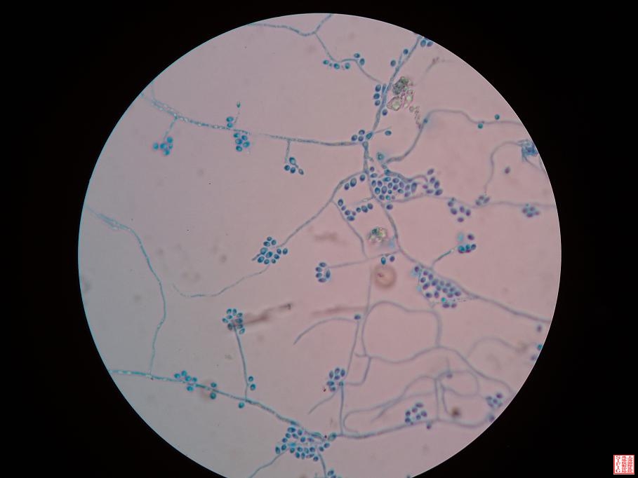 镜下菌丝相０１