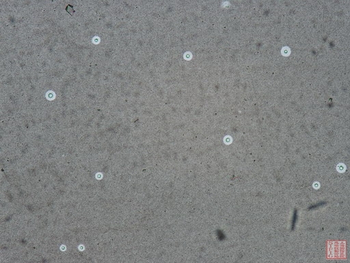 cryptococcus01-1.jpg