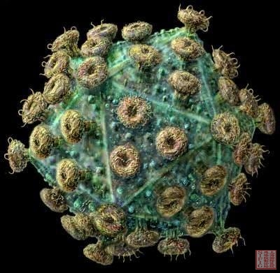 艾滋病病毒显微图.jpg