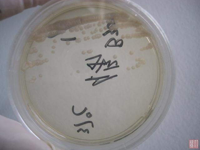 B300 马尔尼菲青霉菌 37度 SDA 4D 正面.JPG
