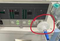 气腹机过滤器更换