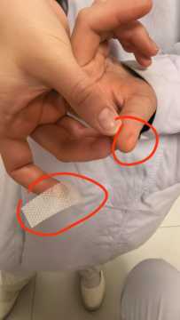 这种情况算职业暴露吗？