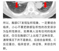 “坠积性改变”和“坠积性炎性改变”您怎么看？