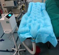 术中保温需要记录吗？