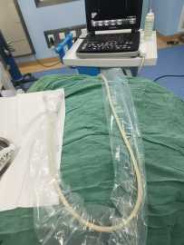 术中在创口、创面、非完整皮肤或黏膜上进行的超声诊断治疗操作怎么做到有效隔离？