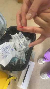 护工被患者咬破手指怎么处理