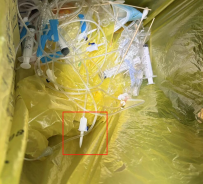 输液管的这个算损伤性医疗废物吗？