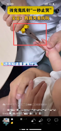 拔出克氏针可以用这样的钳子吗？