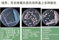 认识耳念株菌，其威胁有哪些，如何进行防控 ？