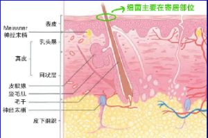 感术行动01丨如何规范进行术前皮肤准备？